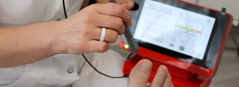 laser diodowy podologiczny stosowany podczas zabiegu wyleczenia kurzajek w gabinecie - Dlaczego laser diodowy 1064 nm to przyszłość Twojego gabinetu?